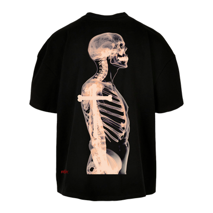 X Ray - T-Shirt