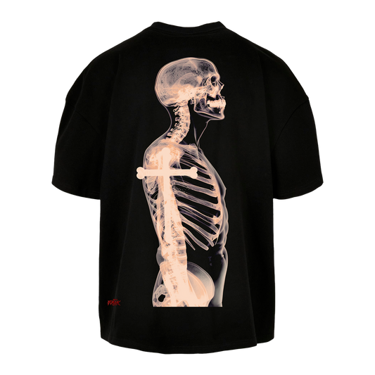 X Ray - T-Shirt